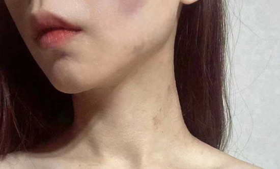 网红雅典娜LIYA死了吗?网传身体四分五裂是真的吗?