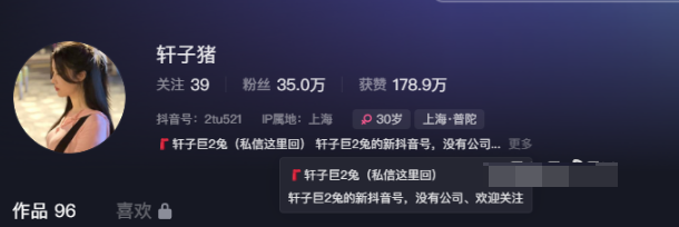重磅回归,网红轩子巨二兔开通微密圈-1 重磅回归,网红轩子巨二兔开通微密圈