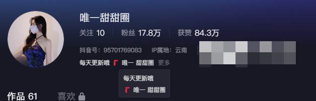抖音网红唯一甜甜圈微密圈资源有什么?-1 抖音网红唯一甜甜圈微密圈资源有什么?