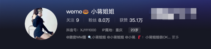-1 小蒋姐姐微密圈子迷人颜值和神秘魅力