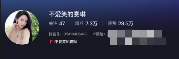 不爱笑的赛琳微密圈,谁说不爱笑了?-1 不爱笑的赛琳微密圈,谁说不爱笑了?
