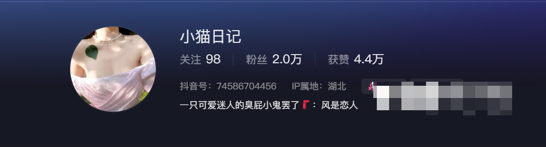 -1 抖音小猫日记小宁hate微密圈的高级感开衫裙作品